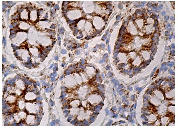 HADHB Antibody (E-1) | SCBT - Santa Cruz Biotechnology