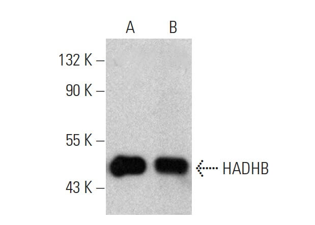 HADHB Antibody (E-1) | SCBT - Santa Cruz Biotechnology