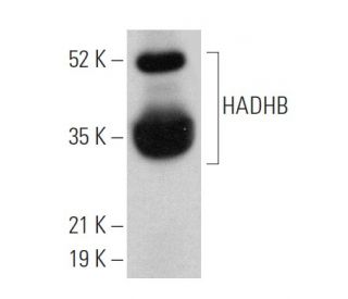 ボヌールページ HADHB Antibody (E-1) | SCBT - Santa Cruz Biotechnology