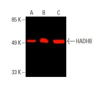HADHB Antibody (E-1) | SCBT - Santa Cruz Biotechnology