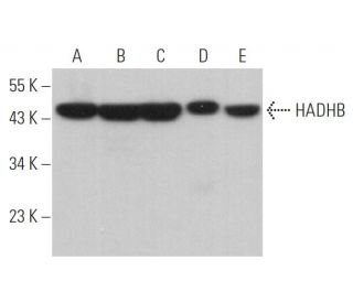 western blotting image from recommended HADHB (E-1) monoclonal antibody replacement. Image 372567