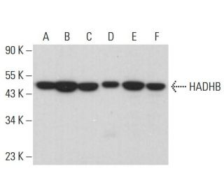HADHB Antibody (C-6) - Western Blotting - Image 375414