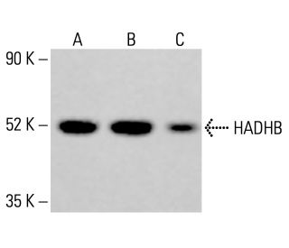 HADHB Antibody (E-1) - Western Blotting - Image 414026