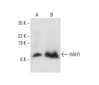 HAH1 Antibody (D-9) - Western Blotting - Image 308330 