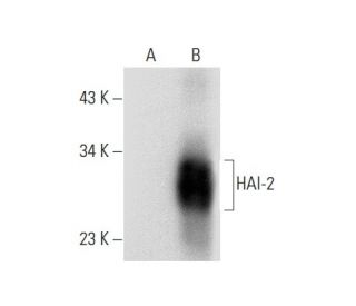 HAI-2 Antibody (H-9) - Western Blotting - Image 301336 