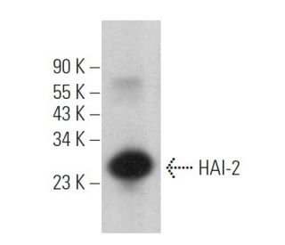 HAI-2 Antibody (H-9) - Western Blotting - Image 366585Each CRISPR/Cas9 Knockout (KO) Plasmid product consists of a pool of 3 plasmids designed to ensure identification and cleavage of a specific gene for maximum knockout efficiency. Each plasmid encodes a unique 20 nt sequence derived from the GeCKO (v2) library.