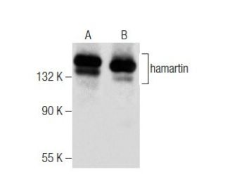 hamartin Antibody (E-7) - Western Blotting - Image 284400 