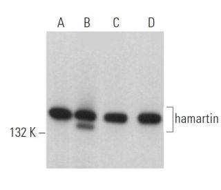 western blotting image from recommended hamartin (C-8) monoclonal antibody replacement. Image 362959