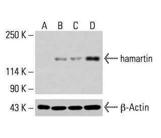 hamartin Antibody (C-8) - Western Blotting - Image 414943