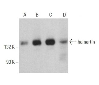 hamartin Antibody (E-7) - Western Blotting - Image 360180