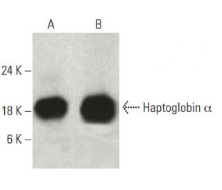 Haptoglobin &alpha; Antibody (B-2) - Western Blotting - Image 396488 