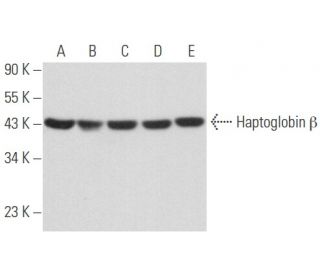 Haptoglobin &beta; Antibody (F-8) - Western Blotting - Image 357481 