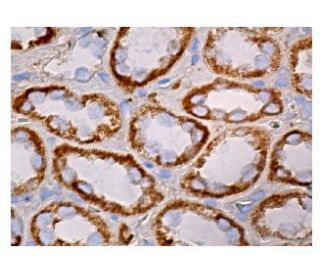 immunohistochemistry image from recommended HAS3 (G-12) monoclonal antibody replacement. Image 161031
