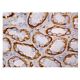 immunohistochemistry image from recommended HAS3 (G-12) monoclonal antibody replacement. Image 161031