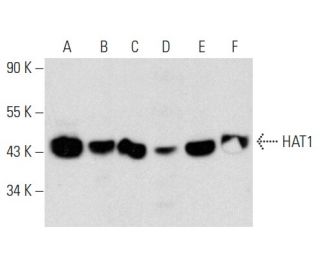 HAT1 Antibody (B-10) - Western Blotting - Image 357296 