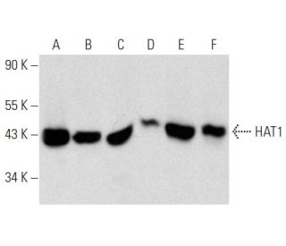 western blotting image from recommended HAT1 (H-7) monoclonal antibody replacement. Image 357297