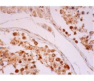 HAUSP Antibody (G-12) - Immunohistochemistry - Image 293326 