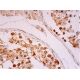 HAUSP Antibody (G-12) - Immunohistochemistry - Image 293326 