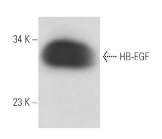 western blotting image from recommended HB-EGF (G-11) monoclonal antibody replacement. Image 15697