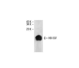 HB-EGF Antibody (E-10) - Western Blotting - Image 17732The Double Nickase Plasmid features a U6 promoter for sgRNA expression, a 20 nt targeting sequence, and a gRNA scaffold to guide Cas9n. It includes a CBh promoter for Cas9n (D10A) and puromycin resistance, GFP for transfection verification, and nuclear localization signals (NLS). The 2A peptide allows co-expression of Cas9n and Puro from a single promoter, enabling precise genome editing with reduced off-target effects.