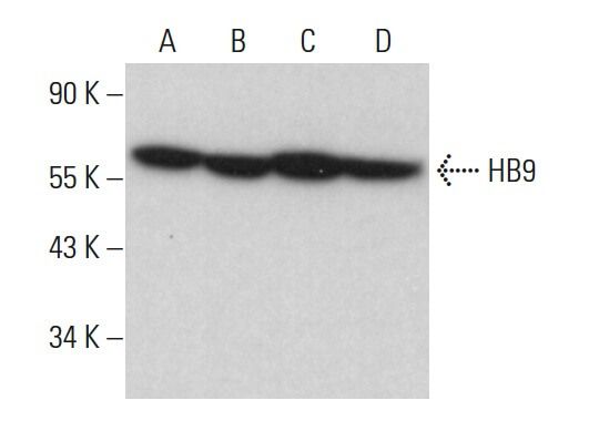 Anti Hb9 Antibody F 5 Scbt Santa Cruz Biotechnology