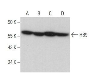 HB9 Antibody (F-5) - Western Blotting - Image 377097