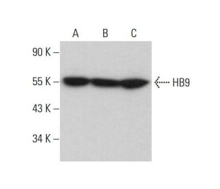 HB9 Antibody (F-5) - Western Blotting - Image 377096Each CRISPR/Cas9 Knockout (KO) Plasmid product consists of a pool of 3 plasmids designed to ensure identification and cleavage of a specific gene for maximum knockout efficiency. Each plasmid encodes a unique 20 nt sequence derived from the GeCKO (v2) library.