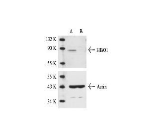 HBO1 siRNA (h): sc-35530. Western blot analysis of HBO1 expression in non-transfected control (A) and HBO1 siRNA transfect 