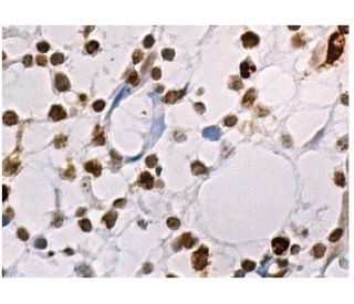 HBXIP Antibody (H-5) - Immunohistochemistry - Image 159589 