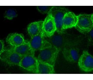CD44 Antibody (DF1485) | SCBT - Santa Cruz Biotechnology