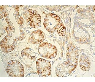 CD44 Antibody (F-4) | SCBT - Santa Cruz Biotechnology