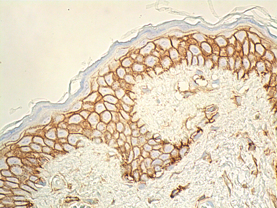 CD44 Antibody (F-4) | SCBT - Santa Cruz Biotechnology