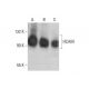 western blotting image from recommended CD44 (DF1485) monoclonal antibody replacement. Image 352076