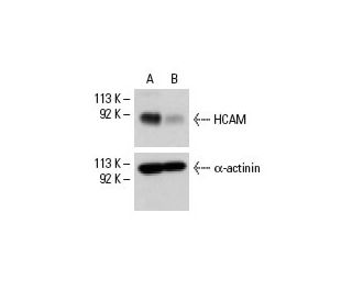 HCAM siRNA (h): sc-29342. Western blot analysis of HCAM expression in non-transfected control (A) and HCAM siRNA transfect 