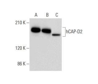 hCAP-D2 Antibody (D-3) - Western Blotting - Image 311966 