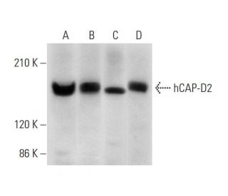 hCAP-D2 Antibody (E-6) - Western Blotting - Image 311965 