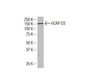 hCAP-D3 Antibody (283.7) - Western Blotting - Image 34380 