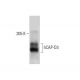hCAP-D3 Antibody (2B5) - Western Blotting - Image 21336 