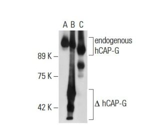 hCAP-G Antibody (YY-2) - Western Blotting - Image 70697 