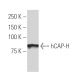 hCAP-H Antibody (H-6) - Western Blotting - Image 34377