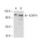 hCAP-H Antibody (H-6) - Western Blotting - Image 52811 