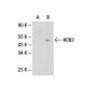 HCN3 Antibody (TLL6C5) - Western Blotting - Image 30424