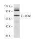 HCN3 Antibody (TLL6C5) - Western Blotting - Image 50145 