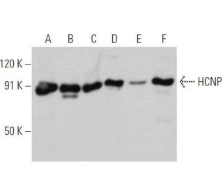 HCNP Antibody (C-9) - Western Blotting - Image 356356 