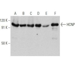 HCNP Antibody (F-1) - Western Blotting - Image 356357 