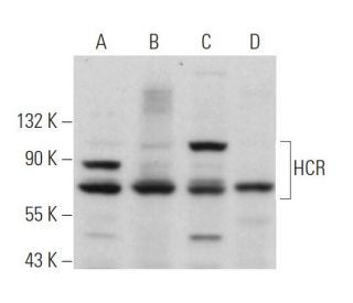 HCR Antibody (E-4) - Western Blotting - Image 367721 