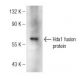 Hda1 Antibody (G-3) - Western Blotting - Image 146397
