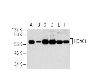 western blotting image from recommended Histone Deacetylase 1 (HDAC1) (10E2) monoclonal antibody replacement. Image 19297