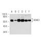 western blotting image from recommended Histone Deacetylase 1 (HDAC1) (10E2) monoclonal antibody replacement. Image 19297