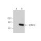 Histone Deacetylase 10 (HDAC10) Antibody (D-9) - Western Blotting - Image 139076
